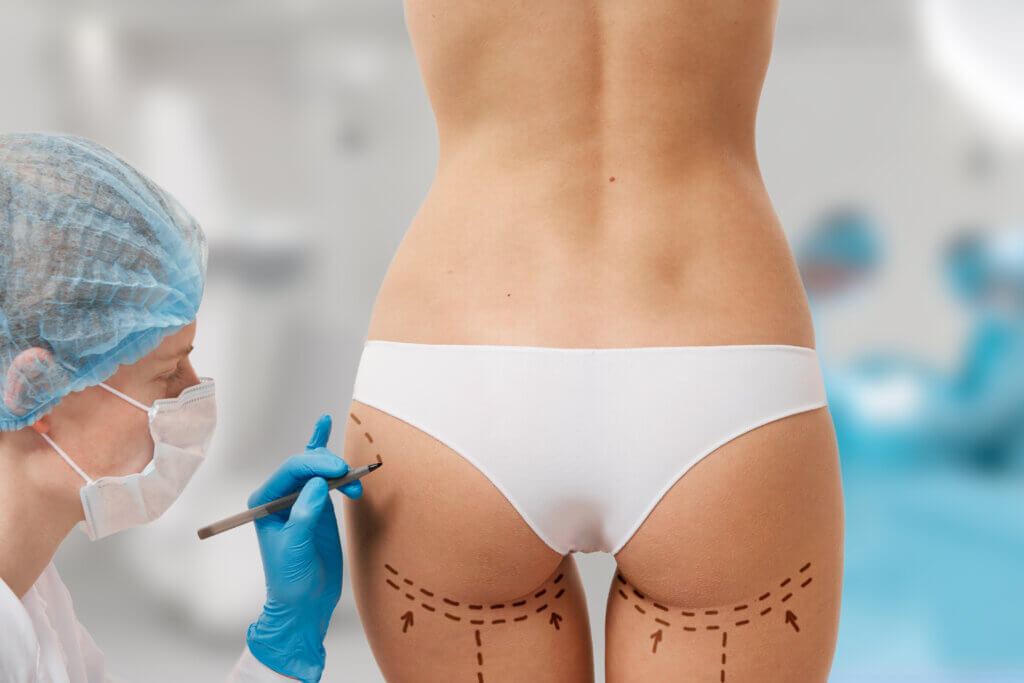 How do I get the best results from Vaser lipo